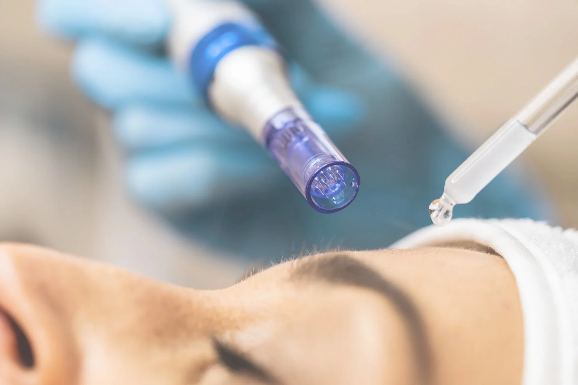 Microneedling Masterclass